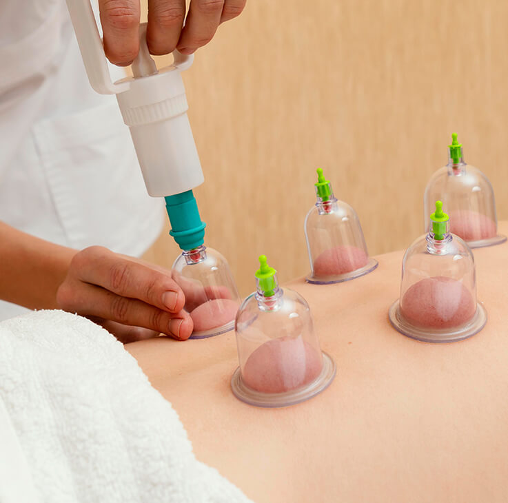 Cupping Therapy in Amritsar